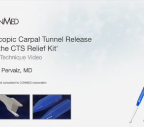 Carpal Tunnel Release Surgical Technique
