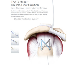 ORTHOPAEDIC SOLUTIONS – SHOULDER – PRODUCTS – Suture Anchors - Medhold ...