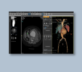 GE X-Ray7