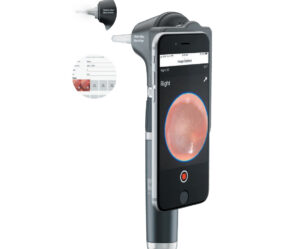 Enhance-Macroview-Otoscope-