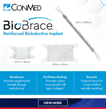 news-AND-INSIGHT-conmedads