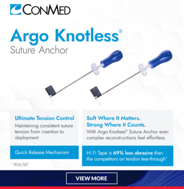 news-AND-INSIGHT-conmedads-b2