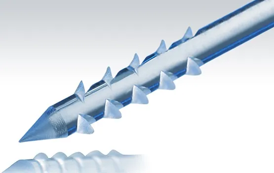 smart-nail-implant_pp_s1