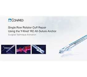 Rotator-cuff-repair