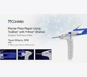 plantar-plat-erepair