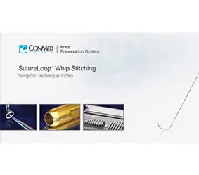 suture-loop