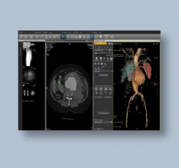 WORKSTATIONADVANTAGE